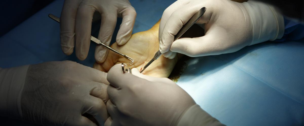 Hand surgery for careers